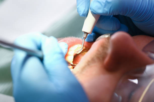 Best Emergency Broken Tooth Repair in Seymour, TN
