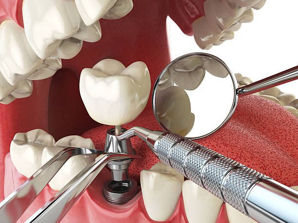 Best Walk-In Emergency Dentist in Seymour, TN